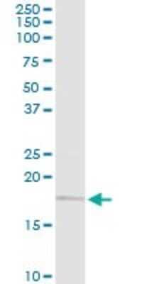 Western Blot: UBE2G2 Antibody [H00007327-D01P]