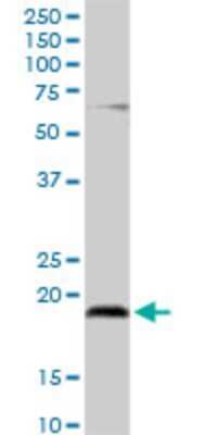 Western Blot: UBE2G2 Antibody [H00007327-D01P]