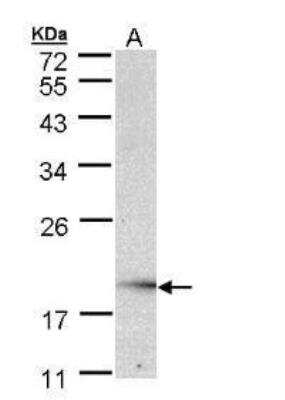 Western Blot: UBE2G2 Antibody [NBP1-32729]