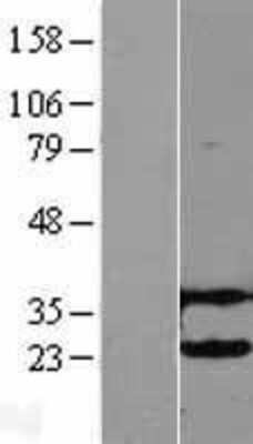 Western Blot: UbcH2/UBE2H Overexpression Lysate [NBL1-17531]