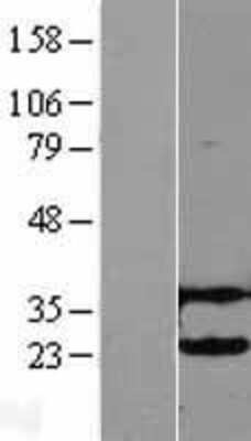 Western Blot: UbcH2/UBE2H Overexpression Lysate [NBL1-17531]