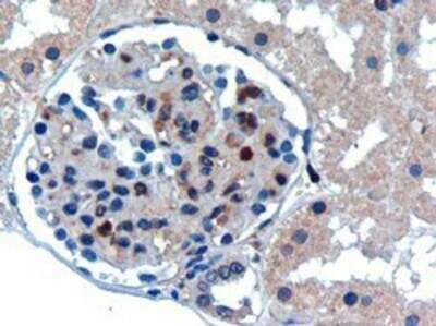 Immunohistochemistry-Paraffin: UBE2I/Ubc9 Antibody [NB300-812]