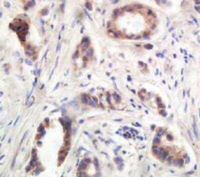 Immunohistochemistry-Paraffin: UBE2I/Ubc9 Antibody [NB300-812]