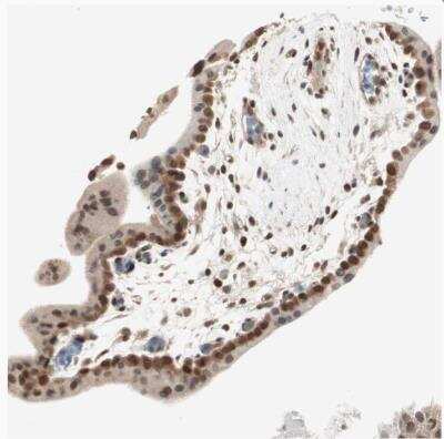 Immunohistochemistry-Paraffin: UBE2I/Ubc9 Antibody [NBP1-86887]