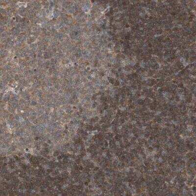 Immunohistochemistry-Paraffin: UBE2I/Ubc9 Antibody [NBP1-86887]