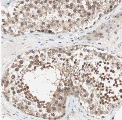 Immunohistochemistry-Paraffin: UBE2I/Ubc9 Antibody [NBP1-86887]