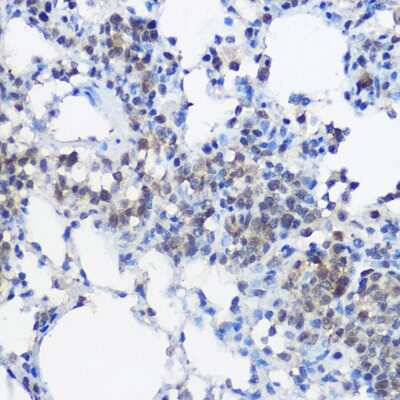 Immunohistochemistry-Paraffin: UBE2I/Ubc9 Antibody - BSA Free [NBP2-93799]