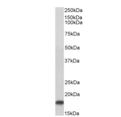Western Blot: UBE2I/Ubc9 Antibody [NB300-812]