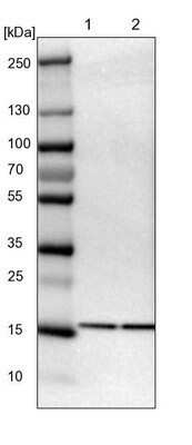 Western Blot: UBE2I/Ubc9 Antibody [NBP1-86887]