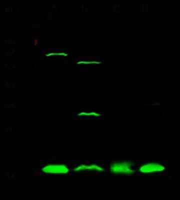 Western Blot: UBE2I/Ubc9 Antibody [NBP3-00096]