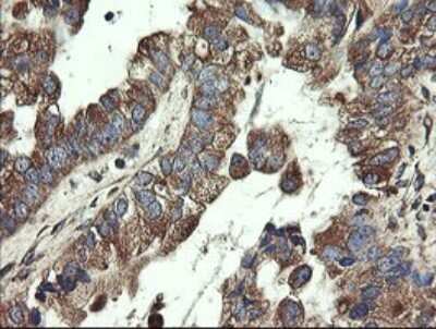Immunohistochemistry: UBE2J1 Antibody (OTI3D1) [NBP2-45402]
