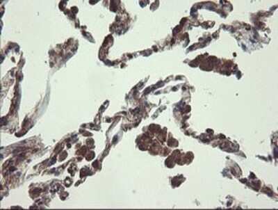 Immunohistochemistry: UBE2J1 Antibody (OTI3D1) [NBP2-45402]