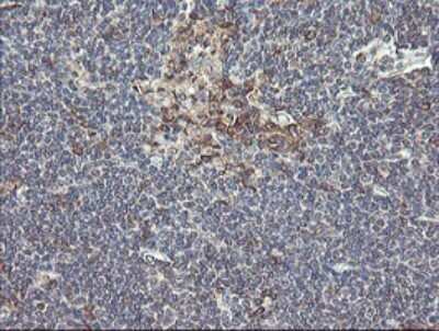 Immunohistochemistry: UBE2J1 Antibody (OTI3D1) [NBP2-45402]