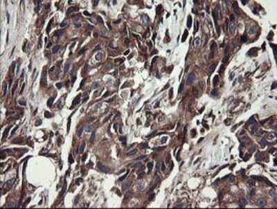 Immunohistochemistry: UBE2J1 Antibody (OTI3D1) [NBP2-45402]