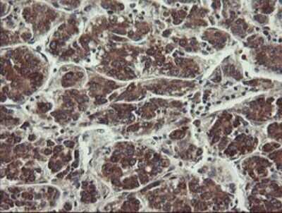 Immunohistochemistry: UBE2J1 Antibody (OTI3D1) [NBP2-45402]