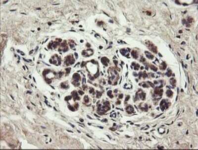 Immunohistochemistry: UBE2J1 Antibody (OTI3D1) [NBP2-45402]