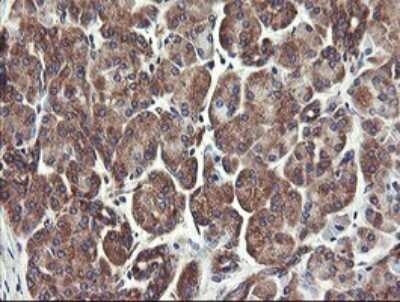 Immunohistochemistry: UBE2J1 Antibody (OTI3D1) [NBP2-45402]