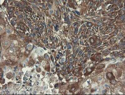 Immunohistochemistry: UBE2J1 Antibody (OTI3D1) [NBP2-45402]
