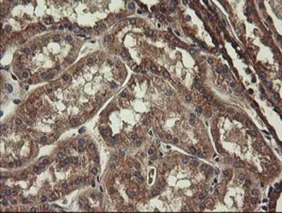 Immunohistochemistry: UBE2J1 Antibody (OTI3D1) [NBP2-45402]