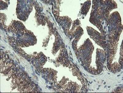 Immunohistochemistry: UBE2J1 Antibody (OTI3D1) [NBP2-45402]