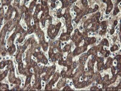 Immunohistochemistry: UBE2J1 Antibody (OTI3D1) [NBP2-45402]
