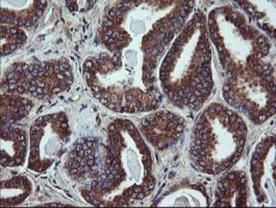 Immunohistochemistry: UBE2J1 Antibody (OTI3D1) [NBP2-45402]