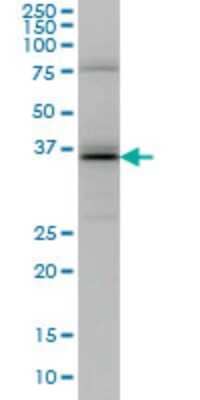 Western Blot: UBE2J1 Antibody (6A12) [H00051465-M01]