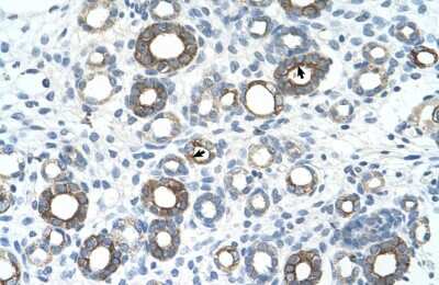 Immunohistochemistry: UBE2J1 Antibody [NBP1-59757]
