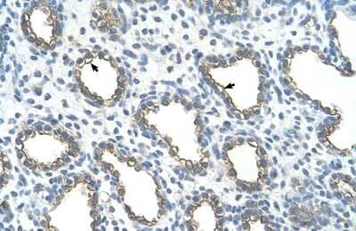 Immunohistochemistry: UBE2J1 Antibody [NBP1-59757]
