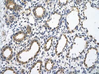 Immunohistochemistry: UBE2J1 Antibody [NBP1-59757]