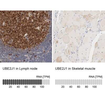 Immunohistochemistry-Paraffin: UBE2J1 Antibody [NBP1-85654]