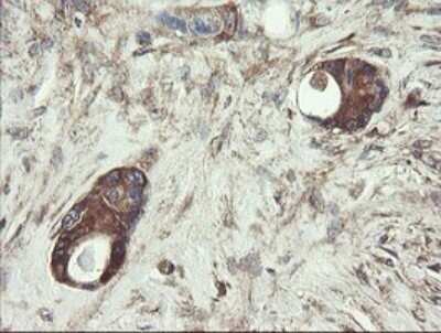 Immunohistochemistry: UBE2J1 Antibody (OTI3D1) - Azide and BSA Free [NBP2-74747]