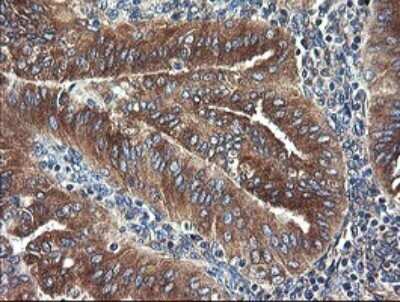 Immunohistochemistry: UBE2J1 Antibody (OTI3D1) - Azide and BSA Free [NBP2-74747]