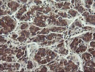 Immunohistochemistry: UBE2J1 Antibody (OTI3D1) - Azide and BSA Free [NBP2-74747]