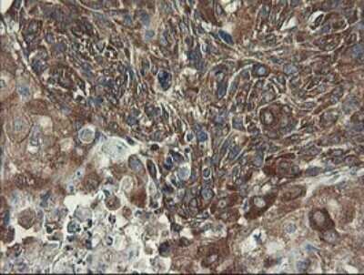 Immunohistochemistry: UBE2J1 Antibody (OTI3D1) - Azide and BSA Free [NBP2-74747]