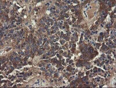 Immunohistochemistry: UBE2J1 Antibody (OTI3D1) - Azide and BSA Free [NBP2-74747]