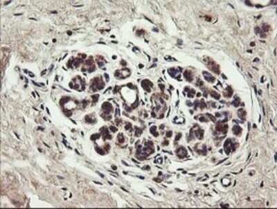 Immunohistochemistry: UBE2J1 Antibody (OTI3D1) - Azide and BSA Free [NBP2-74747]