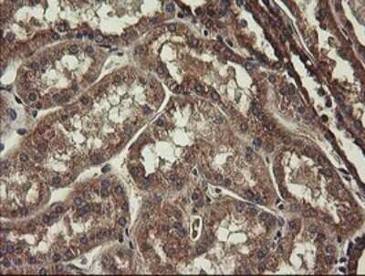 Immunohistochemistry: UBE2J1 Antibody (OTI3D1) - Azide and BSA Free [NBP2-74747]