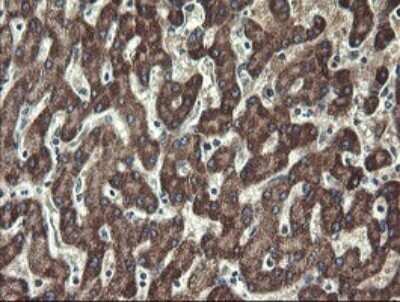 Immunohistochemistry: UBE2J1 Antibody (OTI3D1) - Azide and BSA Free [NBP2-74747]