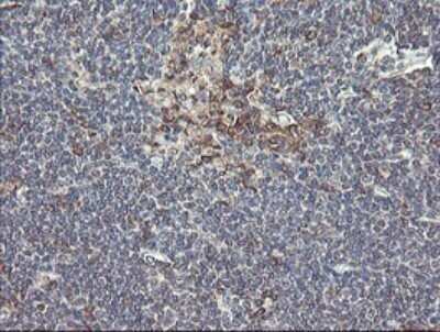 Immunohistochemistry: UBE2J1 Antibody (OTI3D1) - Azide and BSA Free [NBP2-74747]