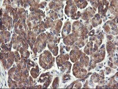 Immunohistochemistry: UBE2J1 Antibody (OTI3D1) - Azide and BSA Free [NBP2-74747]