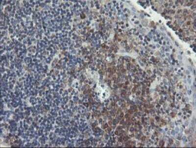 Immunohistochemistry: UBE2J1 Antibody (OTI3D1) - Azide and BSA Free [NBP2-74747]