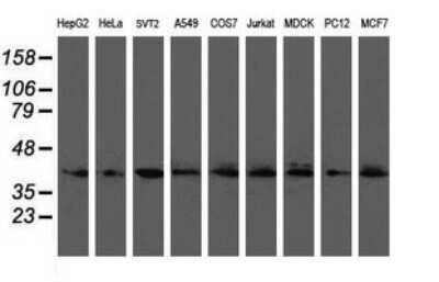 Western Blot: UBE2J1 Antibody (OTI3D1)Azide and BSA Free [NBP2-74747]