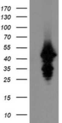 Western Blot: UBE2J1 Antibody (OTI3D1)Azide and BSA Free [NBP2-74747]