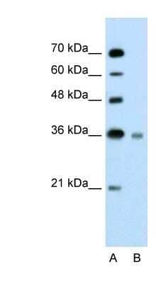 Western Blot: UBE2J1 Antibody [NBP1-59757]