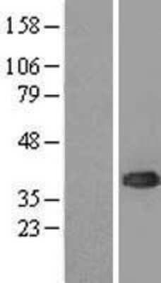 Western Blot: UBE2J1 Overexpression Lysate [NBL1-17534]