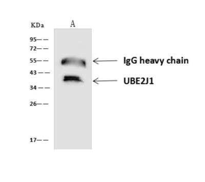 Immunoprecipitation: UBE2J2/UBC6 Antibody [NBP3-06347]