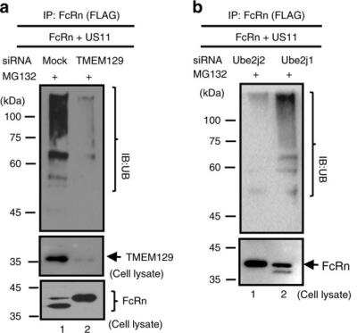 Knockdown Validated: UBE2J2/UBC6 Antibody [NBP1-59760]