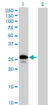 Western Blot: UBE2J2/UBC6 Antibody [H00118424-B01P]