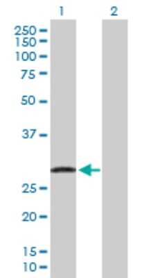 Western Blot: UBE2J2/UBC6 Antibody [H00118424-D01P]